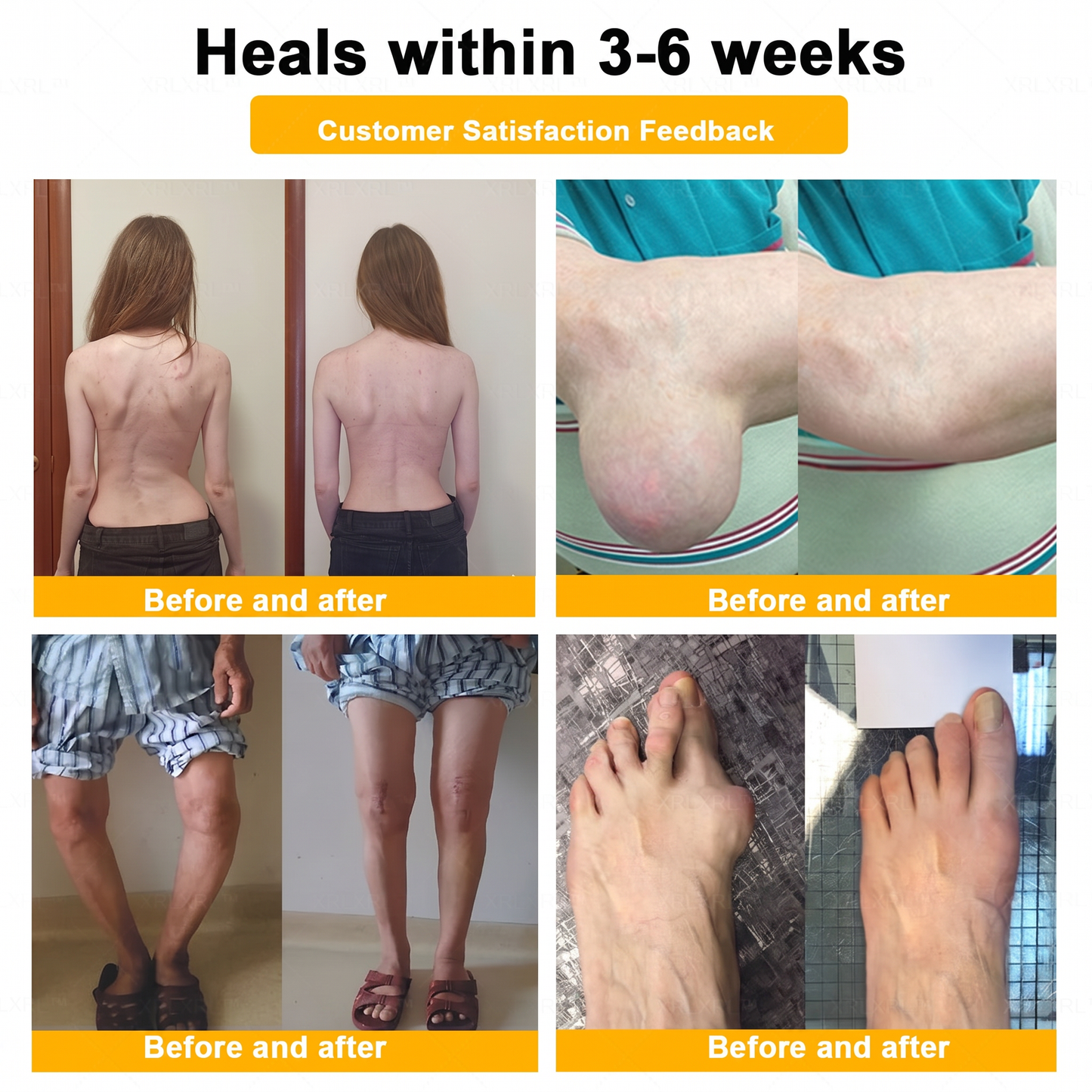 30% Discount🎁🎁|𝐌𝐔𝐑𝐖𝐎𝐍® Bee Venom Pain-Relief Bone Healing Cream ✨✨✨(Specially for older adults)
