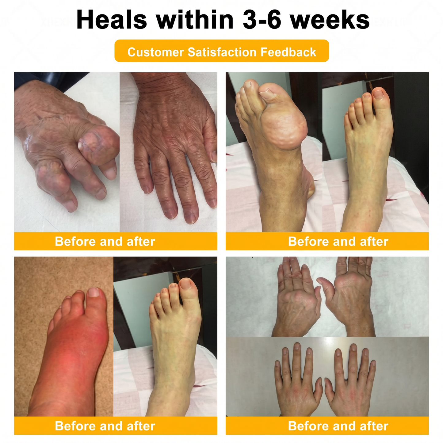 30% Discount🎁🎁|𝐌𝐔𝐑𝐖𝐎𝐍® Bee Venom Pain-Relief Bone Healing Cream ✨✨✨(Specially for older adults)