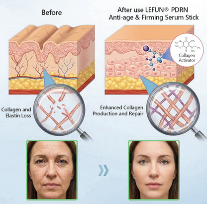 ✨Recommended by Dermatologists👩‍⚕️𝐕𝒾𝐭𝐚𝐥𝐢𝐬𝐲𝐬® 𝑷𝑫𝑹𝐍 Anti-age & Firming Serum Stick 🔥LAST DAY 70% OFF🔥🔥