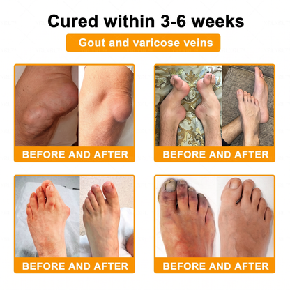 30% Discount🎁🎁|𝐌𝐔𝐑𝐖𝐎𝐍® Bee Venom Pain-Relief Bone Healing Cream ✨✨✨(Specially for older adults)